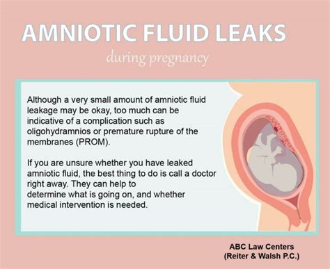 amniotic.fluid leaking|Leaking Amniotic Fluid: Signs, Causes, and。